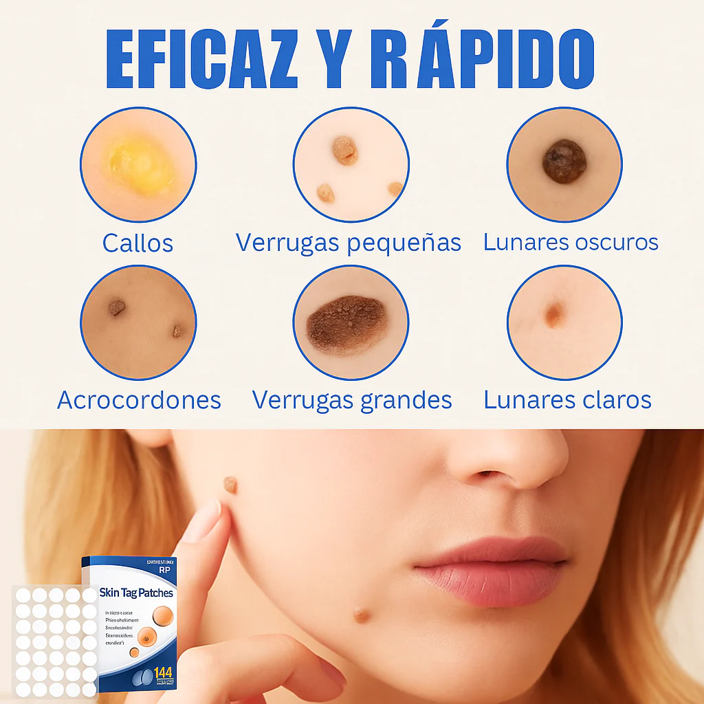 144 parches: alcanza para varias zonas y repeticiones