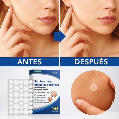 144 parches: alcanza para varias zonas y repeticiones