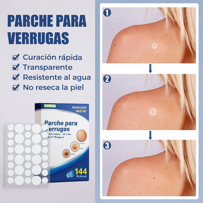 144 parches: alcanza para varias zonas y repeticiones